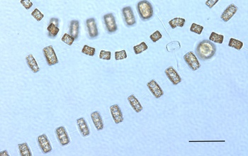 The chain-forming diatom Thalassiosira, seen under a microscope